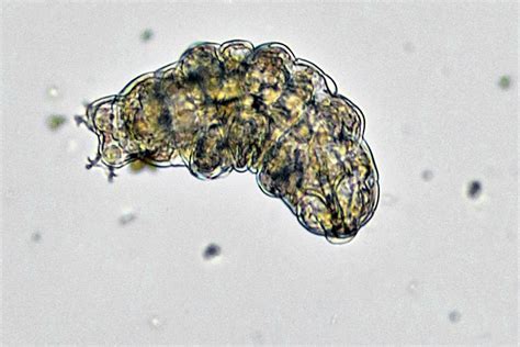  Cryptosporidium! A Tiny Troublemaker Lurking in Your Water