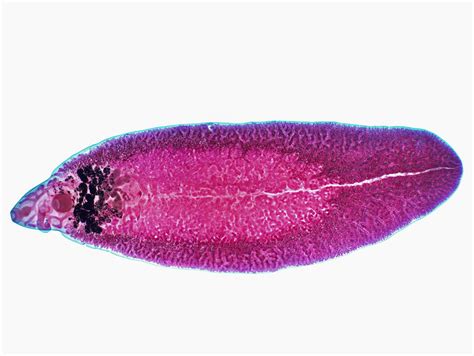  Liver Fluke:  A Microscopic Mastermind That Weaves A Tangled Web Of Parasitism Throughout The Animal Kingdom!